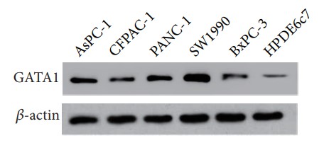 Western blot assay of GATA1 in PDAC and normal pancreatic cell lines.jpg